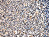 Immunohistochemistry of paraffin-embedded Human tonsil tissue using ENTPD1 Polyclonal Antibody at dilution of 1:60(×200)