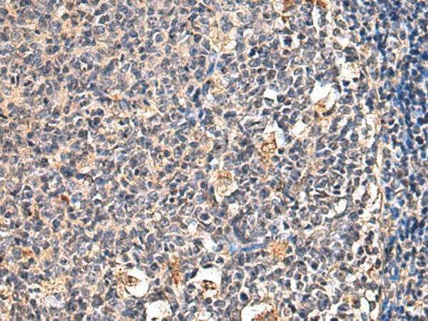Immunohistochemistry of paraffin-embedded Human tonsil tissue using ENTPD1 Polyclonal Antibody at dilution of 1:60(×200)