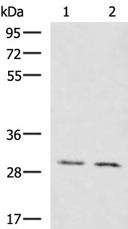 Western blot analysis of Mouse brain tissue Mouse kidney tissue lysates using KRCC1 Polyclonal Antibody at dilution of 1:1350