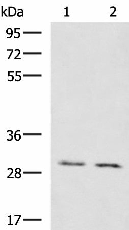 Western blot analysis of Mouse brain tissue Mouse kidney tissue lysates using KRCC1 Polyclonal Antibody at dilution of 1:1350