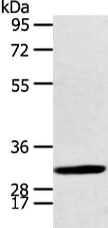 Western blot analysis of Human fetal brian tissue using CALB2 Polyclonal Antibody at dilution of 1:400