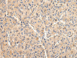 Anti-Human/Mouse/Rat VCAM1 Antibody - ABMIUM
