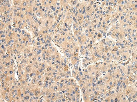 Anti-Human/Mouse/Rat VCAM1 Antibody - ABMIUM