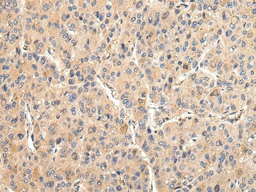 Anti-Human/Mouse/Rat VCAM1 Antibody - ABMIUM