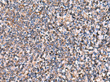 Immunohistochemistry of paraffin-embedded Human tonsil tissue using INSC Polyclonal Antibody at dilution of 1:65(×200)