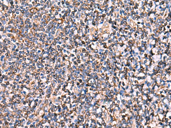 Immunohistochemistry of paraffin-embedded Human tonsil tissue using INSC Polyclonal Antibody at dilution of 1:65(×200)