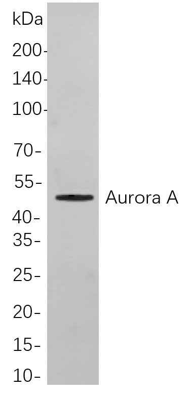 Anti-Human Aurora A Antibody [B863] - ABMIUM