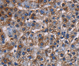 Anti-Human/Mouse/Rat KCNK1 Antibody - ABMIUM