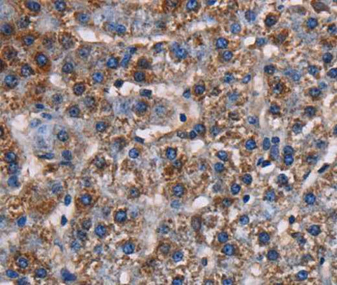 Anti-Human/Mouse/Rat KCNK1 Antibody