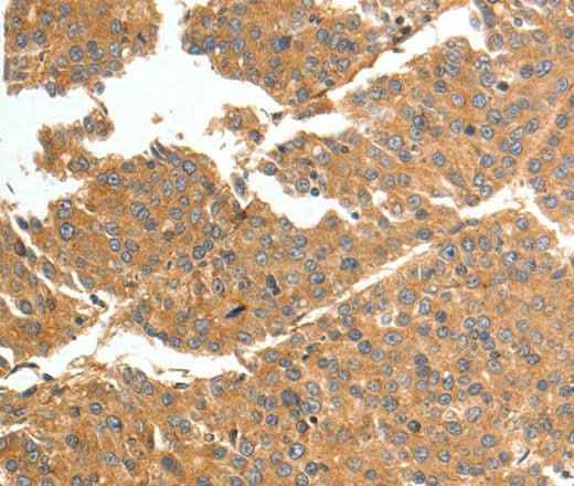 Anti-Human/Mouse TNN Antibody