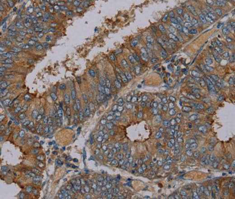 Anti-Human/Mouse/Rat PYY Antibody