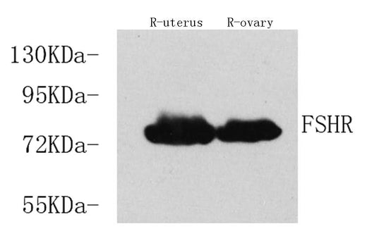 Western Blot analysis of various samples using FSHR Polyclonal Antibody at dilution of 1:750.