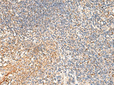 Immunohistochemistry of paraffin-embedded Human tonsil tissue using DUSP7 Polyclonal Antibody at dilution of 1:50(×200)