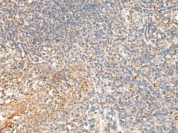 Anti-Human/Mouse/Rat DUSP7 Antibody