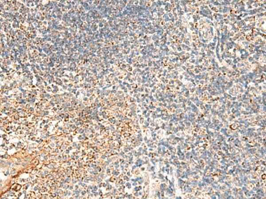 Anti-Human/Mouse/Rat DUSP7 Antibody