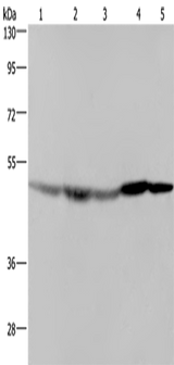 Anti-Human/Mouse/Rat FH Antibody - ABMIUM