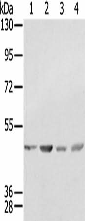 Anti-Human SSB Antibody - ABMIUM