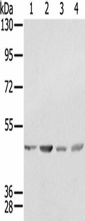 Anti-Human SSB Antibody - ABMIUM