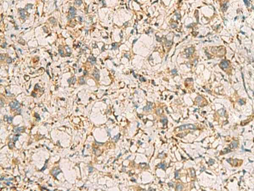 Anti-Human/Mouse/Rat PRKRA Antibody