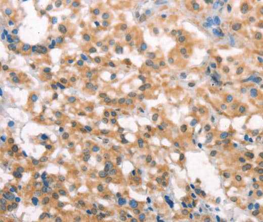 Anti-Human/Mouse LATS2 Antibody