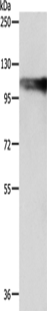Anti-Human/Mouse/Rat AARS2 Antibody - ABMIUM