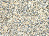 Immunohistochemistry of paraffin-embedded Human tonsil tissue using TMEM9 Polyclonal Antibody at dilution of 1:50(×200)