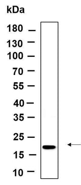 Anti-Human/Mouse/Rat Osteocalcin Antibody [B1152]