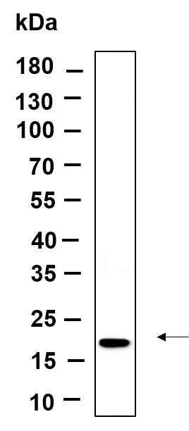 Anti-Human/Mouse/Rat Osteocalcin Antibody [B1152]