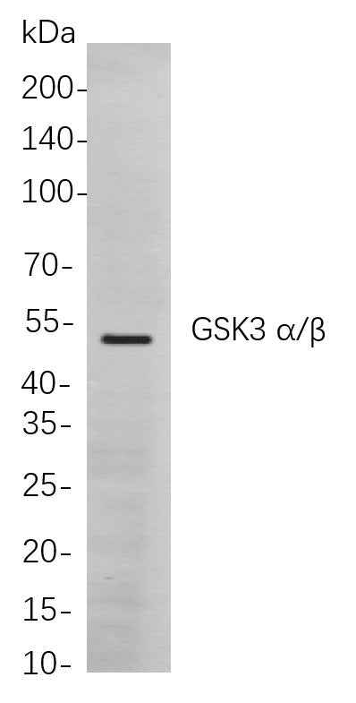 Anti-Human/Mouse/Rat GSK3 α/β Antibody [B847] - ABMIUM
