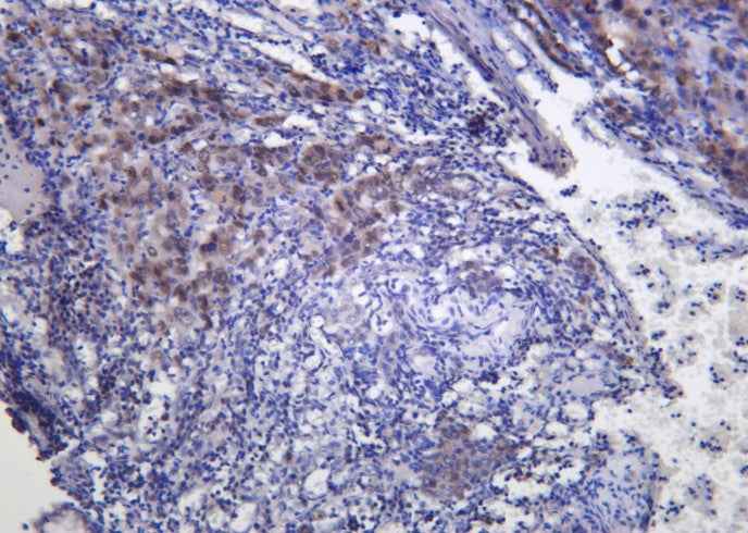 Anti-Human/Mouse/Rat FRA1 Antibody [B1010] - ABMIUM