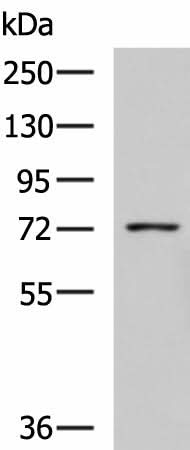 Western blot analysis of K562 cell lysate using GUSB Polyclonal Antibody at dilution of 1:800