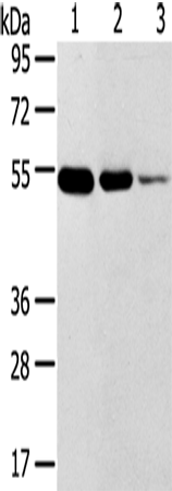 Anti-Human/Mouse TMPRSS11F Antibody - ABMIUM