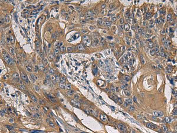 Anti-Human/Mouse CCNI Antibody