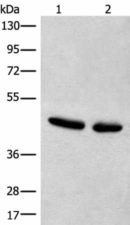 Western blot analysis of Hela and A375 cell lysates using CANT1 Polyclonal Antibody at dilution of 1:500
