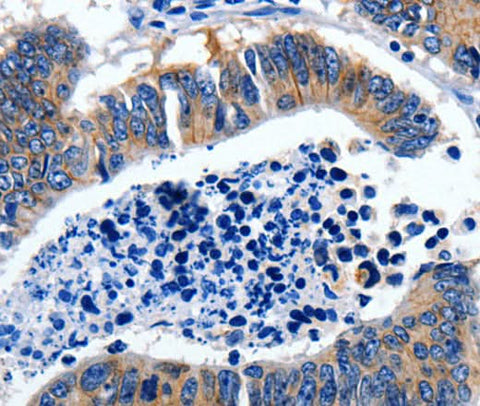 Anti-Human GAD2 Antibody - ABMIUM