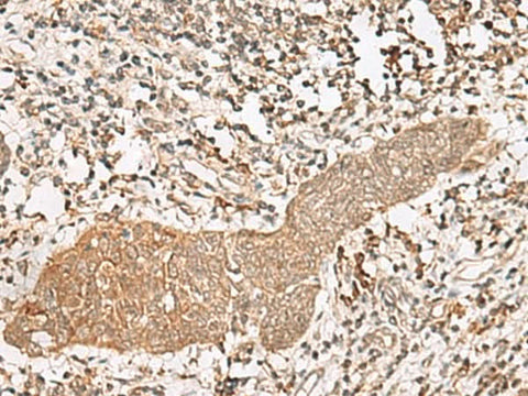 Anti-Human/Mouse/Rat FGF13 Antibody - ABMIUM
