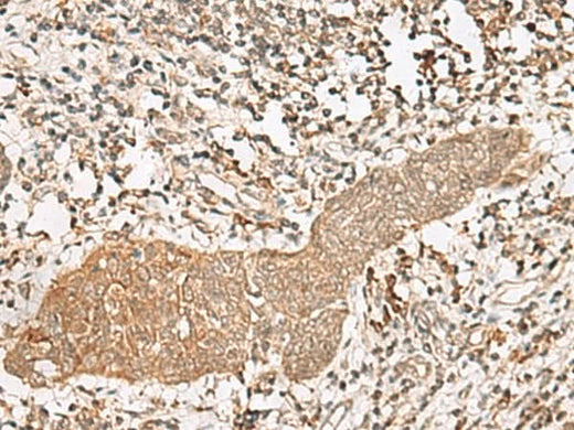 Anti-Human/Mouse/Rat FGF13 Antibody - ABMIUM