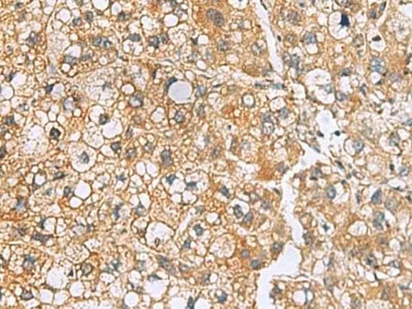 Anti-Human/Mouse/Rat MRPL22 Antibody