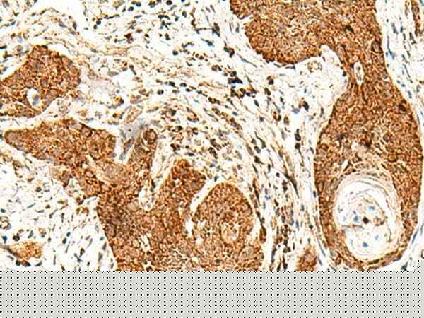 Anti-Human/Mouse SMOC1 Antibody