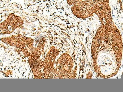 Anti-Human/Mouse SMOC1 Antibody