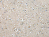Immunohistochemistry of paraffin-embedded Human brain tissue using VILL Polyclonal Antibody at dilution of 1:65(×200)