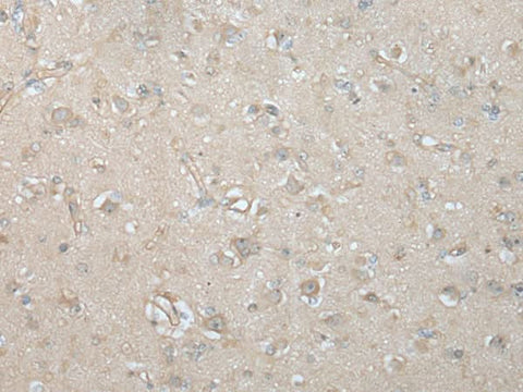 Immunohistochemistry of paraffin-embedded Human brain tissue using VILL Polyclonal Antibody at dilution of 1:65(×200)