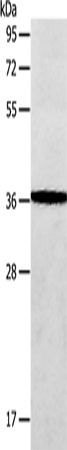 Anti-Human/Mouse/Rat AASDHPPT Antibody - ABMIUM