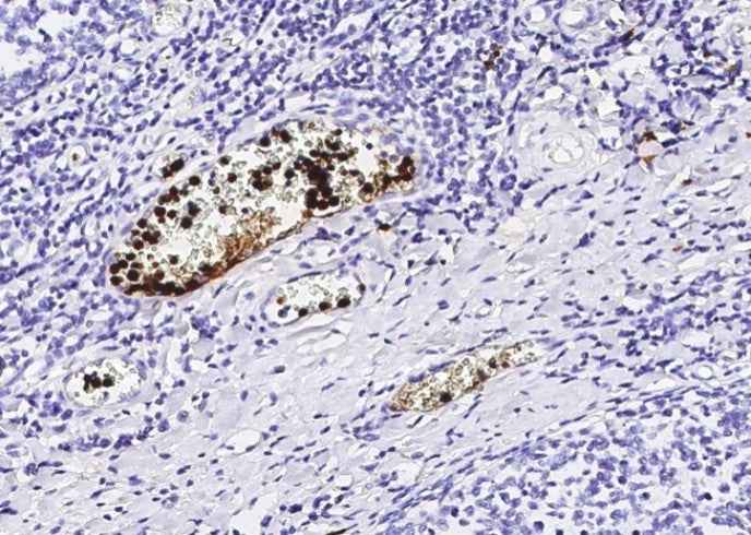 Anti-Human S100A12 Antibody [A1245] - ABMIUM
