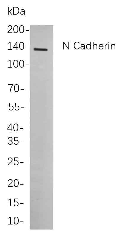 Anti-Human/Mouse/Rat N Cadherin Antibody [B734]