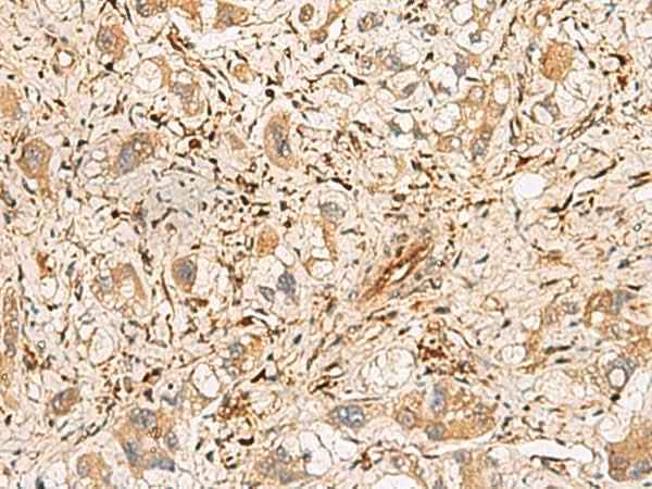 Anti-Human/Mouse/Rat PLCB2 Antibody