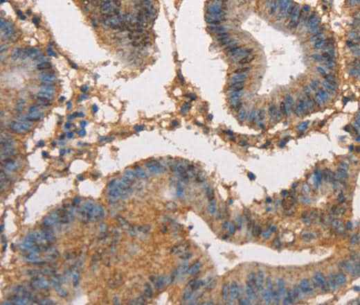Anti-Human/Mouse/Rat HK3 Antibody