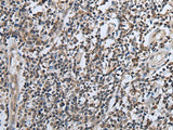 Immunohistochemistry of paraffin-embedded Human tonsil tissue using CXCL6 Polyclonal Antibody at dilution of 1:60(×200)