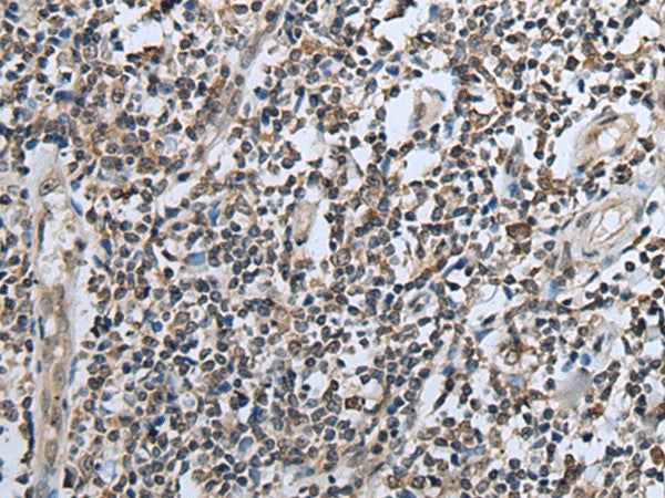 Immunohistochemistry of paraffin-embedded Human tonsil tissue using CXCL6 Polyclonal Antibody at dilution of 1:60(×200)