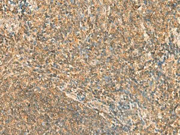 Anti-Human/Mouse SSSCA1 Antibody